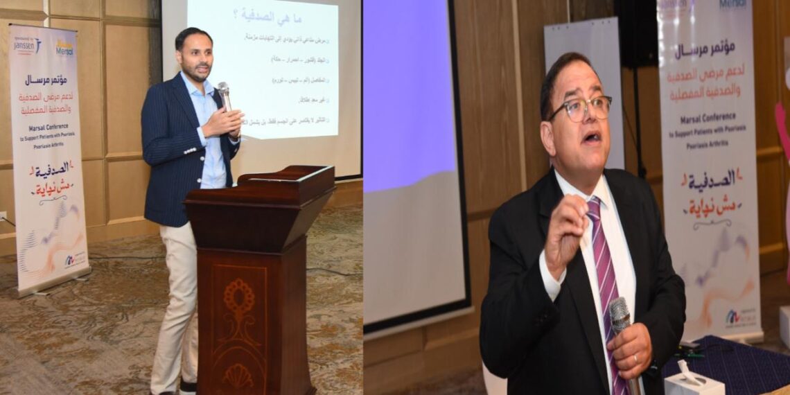 *مرسال عضو التحالف الوطني تنظم فعالية طبية للتوعية بمرض الصدفية*