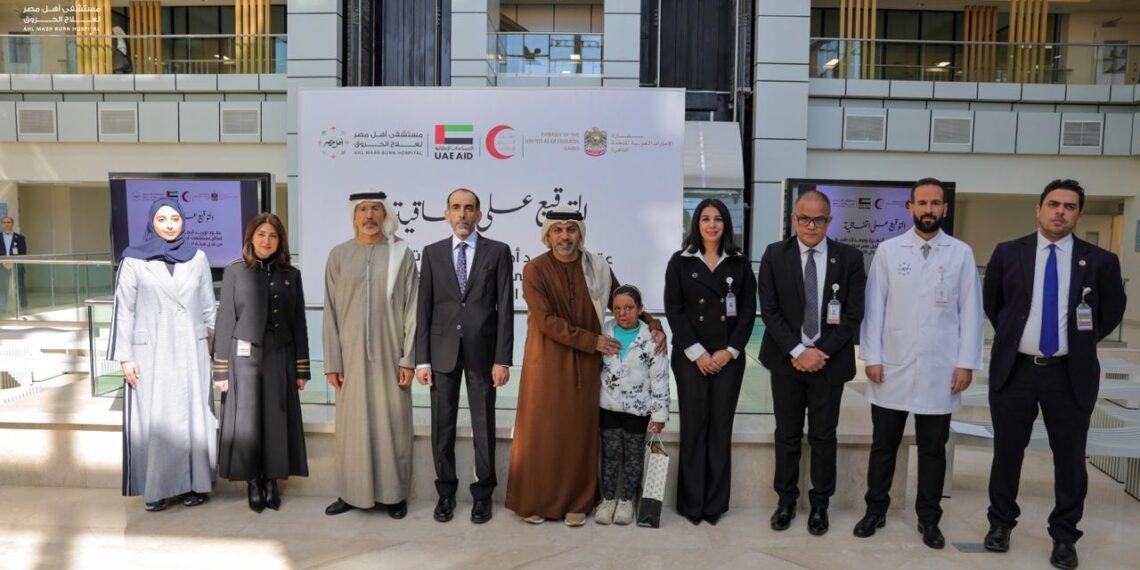 تعاون مصري إماراتي لاستكمال المرحلة الثانية من مستشفى أهل مصر لعلاج الحروق